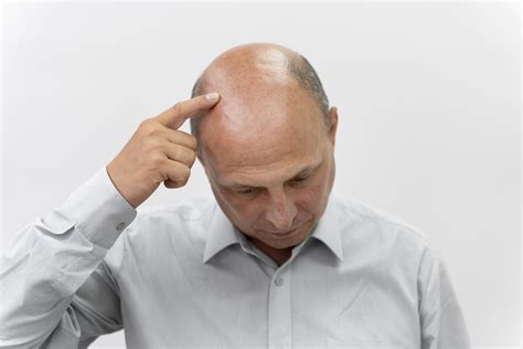 Wat Zijn De Beste Nazorgproducten Voor Haartransplantatie?